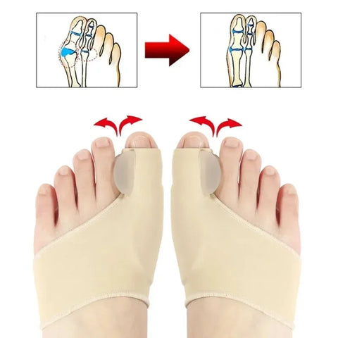 Hallux valgus orthosis shoe-wearing big toe phalanx protrusion toe separation correction magical device separated foot protector