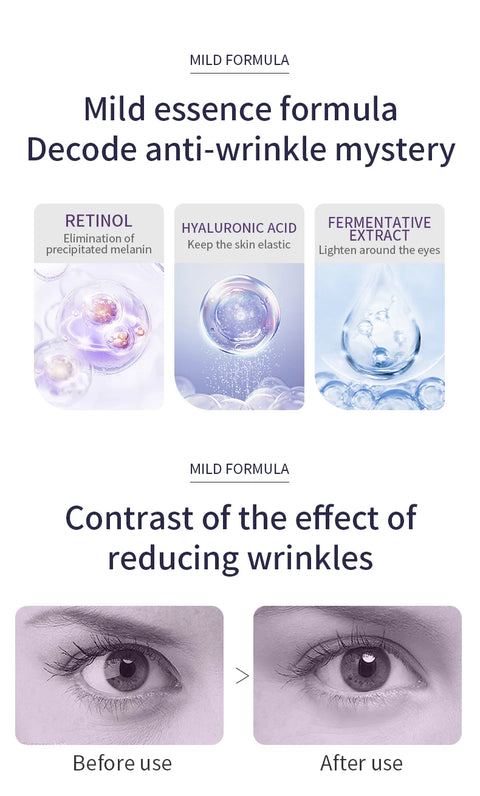 O'CHEAL Anti Wrinkle Anti Dark Circle Eye Cream Roller Massager Moisturizing Eye Bags Anti Aging Hyaluronic Acid Eye Skin Care